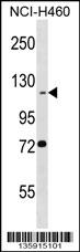 BEND3 Antibody (C-term) (Cat. #AP16612b) western blot analysis in NCI-H460 cell line lysates (35ug/lane).This demonstrates the BEND3 antibody detected the BEND3 protein (arrow).