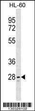 TLCD1 Antibody (C-term) (Cat. #AP16573b) western blot analysis in HL-60 cell line lysates (35ug/lane).This demonstrates the TLCD1 antibody detected the TLCD1 protein (arrow).