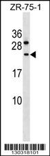 CCDC140 Antibody (N-term) (Cat. #AP16571a) western blot analysis in ZR-75-1 cell line lysates (35ug/lane).This demonstrates the CCDC140 antibody detected the CCDC140 protein (arrow).