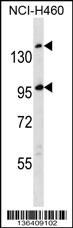 SSC5D Antibody (Cat. #AP16565c) western blot analysis in NCI-H460 cell line lysates (35ug/lane).This demonstrates the SSC5D antibody detected the SSC5D protein (arrow).