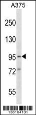 SYDE1 Antibody (N-term) (Cat. #AP16549a) western blot analysis in A375 cell line lysates (35ug/lane).This demonstrates the SYDE1 antibody detected the SYDE1 protein (arrow).