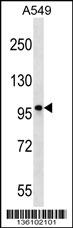 CCDC141 Antibody (N-term) (Cat. #AP16548a) western blot analysis in A549 cell line lysates (35ug/lane).This demonstrates the CCDC141 antibody detected the CCDC141 protein (arrow).