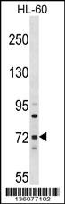 MTMR6 Antibody (N-term) (Cat. #AP16543a) western blot analysis in HL-60 cell line lysates (35ug/lane).This demonstrates the MTMR6 antibody detected the MTMR6 protein (arrow).