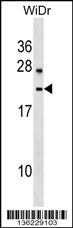 LYZL6 Antibody (Center) (Cat. #AP16919c) western blot analysis in WiDr cell line lysates (35ug/lane).This demonstrates the LYZL6 antibody detected the LYZL6 protein (arrow).