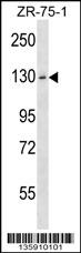 HKDC1 Antibody (C-term) (Cat. #AP16912b) western blot analysis in ZR-75-1 cell line lysates (35ug/lane).This demonstrates the HKDC1 antibody detected the HKDC1 protein (arrow).