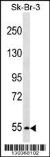 PCSK4 Antibody (N-term) (Cat. #AP16878a) western blot analysis in SK-BR-3 cell line lysates (35ug/lane).This demonstrates the PCSK4 antibody detected the PCSK4 protein (arrow).