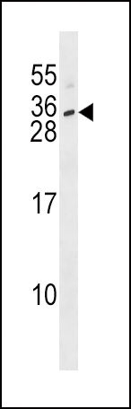 IL28B Antibody (N-term) (Cat. #AP16853a) western blot analysis in SK-BR-3 cell line lysates (35ug/lane).This demonstrates the IL28B antibody detected the IL28B protein (arrow).