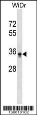 PIGL Antibody (N-term) (Cat. #AP16850a) western blot analysis in WiDr cell line lysates (35ug/lane).This demonstrates the PIGL antibody detected the PIGL protein (arrow).