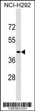 LIPN Antibody (C-term) (Cat. #AP16829b) western blot analysis in NCI-H292 cell line lysates (35ug/lane).This demonstrates the LIPN antibody detected the LIPN protein (arrow).