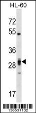 PLEKHF2 Antibody (Center) (Cat. #AP16820c) western blot analysis in HL-60 cell line lysates (35ug/lane).This demonstrates the PLEKHF2 antibody detected the PLEKHF2 protein (arrow).