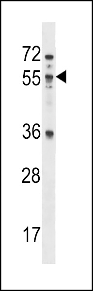 MEX3B Antibody (N-term) (Cat. #AP16808a) western blot analysis in NCI-H460 cell line lysates (35ug/lane).This demonstrates the MEX3B antibody detected the MEX3B protein (arrow).