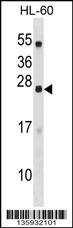 C18orf26 Antibody (N-term) (Cat. #AP16785a) western blot analysis in HL-60 cell line lysates (35ug/lane).This demonstrates the C18orf26 antibody detected the C18orf26 protein (arrow).
