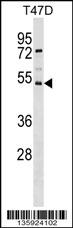 SVOPL Antibody (Center) (Cat. #AP16781c) western blot analysis in T47D cell line lysates (35ug/lane).This demonstrates the SVOPL antibody detected the SVOPL protein (arrow).