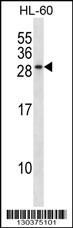 RAB15 Antibody (Center) (Cat. #AP16770c) western blot analysis in HL-60 cell line lysates (35ug/lane).This demonstrates the RAB15 antibody detected the RAB15 protein (arrow).