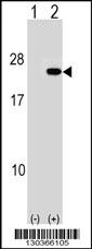 Western blot analysis of PAIP2 (arrow) using rabbit polyclonal PAIP2 Antibody (N-term) (Cat. #AP16769a). 293 cell lysates (2 ug/lane) either nontransfected (Lane 1) or transiently transfected (Lane 2) with the PAIP2 gene.