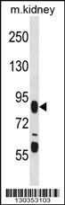 FIGN Antibody (C-term) (Cat. #AP16768b) western blot analysis in mouse kidney tissue lysates (35ug/lane).This demonstrates the FIGN antibody detected the FIGN protein (arrow).