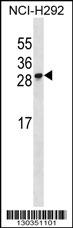 RFESD Antibody (Center) (Cat. #AP16767c) western blot analysis in NCI-H292 cell line lysates (35ug/lane).This demonstrates the RFESD antibody detected the RFESD protein (arrow).