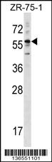 KRT3 Antibody (Center) (Cat. #AP16759c) western blot analysis in ZR-75-1 cell line lysates (35ug/lane).This demonstrates the KRT3 antibody detected the KRT3 protein (arrow).