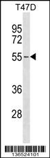 ERGIC2 Antibody (C-term) (Cat. #AP16756b) western blot analysis in T47D cell line lysates (35ug/lane).This demonstrates the ERGIC2 antibody detected the ERGIC2 protein (arrow).