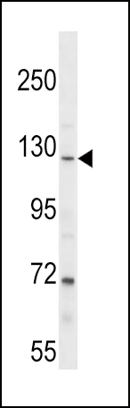 PARG Antibody (C-term) (Cat. #AP16714b) western blot analysis in NCI-H292 cell line lysates (35ug/lane).This demonstrates the PARG antibody detected the PARG protein (arrow).