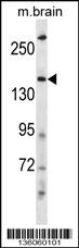 HECW2 Antibody (Center) (Cat. #AP16705c) western blot analysis in mouse brain tissue lysates (35ug/lane).This demonstrates the HECW2 antibody detected the HECW2 protein (arrow).