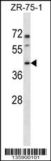 PANX3 Antibody (N-term) (Cat. #AP16688a) western blot analysis in ZR-75-1 cell line lysates (35ug/lane).This demonstrates the PANX3 antibody detected the PANX3 protein (arrow).