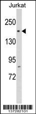 RPAP1 Antibody (N-term) (Cat. #AP17128a) western blot analysis in Jurkat cell line lysates (35ug/lane).This demonstrates the RPAP1 antibody detected the RPAP1 protein (arrow).