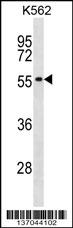 POLR1E Antibody (Center) (Cat. #AP17099c) western blot analysis in K562 cell line lysates (35ug/lane).This demonstrates the POLR1E antibody detected the POLR1E protein (arrow).