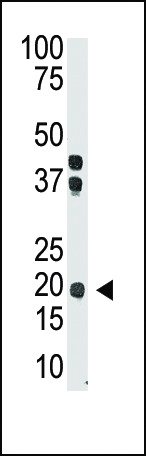 The anti-IL28 Ctr-term Pab (Cat. #AP1708b) is used in Western blot to detect IL28 in mouse brain tissue lysate.