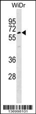 TULP1 Antibody (Center) (Cat. #AP17083c) western blot analysis in WiDr cell line lysates (35ug/lane).This demonstrates the TULP1 antibody detected the TULP1 protein (arrow).