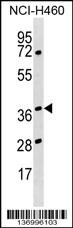 HNRNPH3 Antibody (Center) (Cat. #AP17082c) western blot analysis in NCI-H460 cell line lysates (35ug/lane).This demonstrates the HNRNPH3 antibody detected the HNRNPH3 protein (arrow).