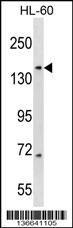 RIMBP3 Antibody (N-term) (Cat. #AP16969a) western blot analysis in HL-60 cell line lysates (35ug/lane).This demonstrates the RIMBP3 antibody detected the RIMBP3 protein (arrow).