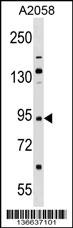 TRIM42 Antibody (Center) (Cat. #AP16968c) western blot analysis in A2058 cell line lysates (35ug/lane).This demonstrates the TRIM42 antibody detected the TRIM42 protein (arrow).