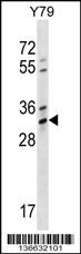 OR4K1 Antibody (N-term) (Cat. #AP16967a) western blot analysis in Y79 cell line lysates (35ug/lane).This demonstrates the OR4K1 antibody detected the OR4K1 protein (arrow).