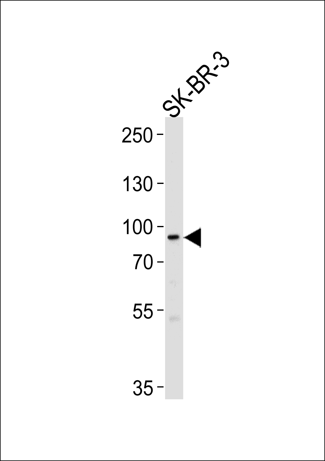 Western blot analysis of lysate from SK-BR-3 cell line, using MTIF2 Antibody (N-term)(Cat. #AP16956a). AP16956a was diluted at 1:1000 at each lane. A goat anti-rabbit IgG H&L(HRP) at 1:5000 dilution was used as the secondary antibody. Lysate at 35ug per lane.