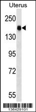 CGNL1 Antibody (N-term) (Cat. #AP16937a) western blot analysis in human normal Uterus tissue lysates (35ug/lane).This demonstrates the CGNL1 antibody detected the CGNL1 protein (arrow).