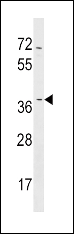 NMNAT2 Antibody (N-term) (Cat. #AP17277a) western blot analysis in NCI-H460 cell line lysates (35ug/lane).This demonstrates the NMNAT2 antibody detected the NMNAT2 protein (arrow).