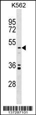 UST Antibody (C-term) (Cat. #AP17272b) western blot analysis in K562 cell line lysates (35ug/lane).This demonstrates the UST antibody detected the UST protein (arrow).