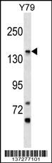 PIGO Antibody (C-term) (Cat. #AP17269b) western blot analysis in Y79 cell line lysates (35ug/lane).This demonstrates the PIGO antibody detected the PIGO protein (arrow).