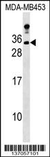 LIN7A Antibody (C-term) (Cat. #AP17246b) western blot analysis in MDA-MB453 cell line lysates (35ug/lane).This demonstrates the LIN7A antibody detected the LIN7A protein (arrow).