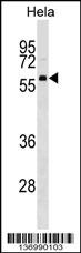 TH1L Antibody (C-term) (Cat. #AP17236b) western blot analysis in Hela cell line lysates (35ug/lane).This demonstrates the TH1L antibody detected the TH1L protein (arrow).