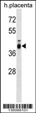 ZP3 Antibody (C-term) (Cat. #AP17235b) western blot analysis in human placenta tissue lysates (35ug/lane).This demonstrates the ZP3 antibody detected the ZP3 protein (arrow).