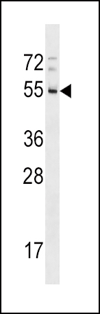 RHD Antibody (Center) (Cat. #AP17214c) western blot analysis in A549 cell line lysates (35ug/lane).This demonstrates the RHD antibody detected the RHD protein (arrow).