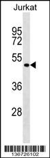 FOXB2 Antibody (N-term) (Cat. #AP17193a) western blot analysis in Jurkat cell line lysates (35ug/lane).This demonstrates the FOXB2 antibody detected the FOXB2 protein (arrow).