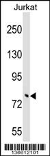 TRIM46 Antibody (N-term) (Cat. #AP17174a) western blot analysis in Jurkat cell line lysates (35ug/lane).This demonstrates the TRIM46 antibody detected the TRIM46 protein (arrow).