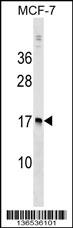 NUDT4 Antibody (N-term) (Cat. #AP17167a) western blot analysis in MCF-7 cell line lysates (35ug/lane).This demonstrates the NUDT4 antibody detected the NUDT4 protein (arrow).