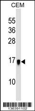 HSPC159 Antibody (Center) (Cat. #AP17159c) western blot analysis in CEM cell line lysates (35ug/lane).This demonstrates the HSPC159 antibody detected the HSPC159 protein (arrow).