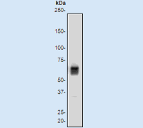 A. Western blot analysis on Jurkat cell lysate using anti-LBR RabMAb (Cat. #AJ1433a), dilution 1:500.