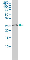 RASL11B monoclonal antibody (M01), clone 1B5 Western Blot analysis of RASL11B expression in K-562 ( (Cat # AT3582a )