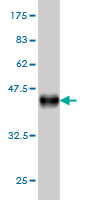 Antibody Reactive Against Recombinant Protein.Western Blot detection against Immunogen (36.74 KDa) . 